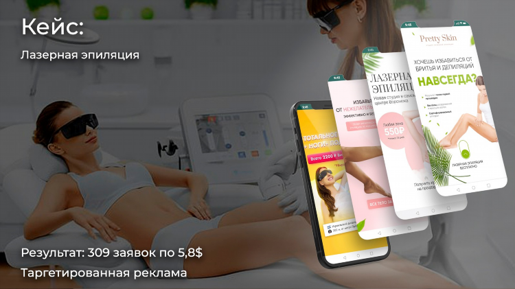 Лазерная эпиляция объявление
